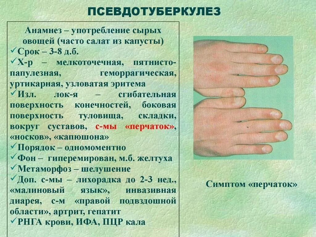 Псевдотуберкулез симптомы фото Псевдотуберкулез у детей: 6 предрасполагающих факторов, 5 групп симптомов, метод