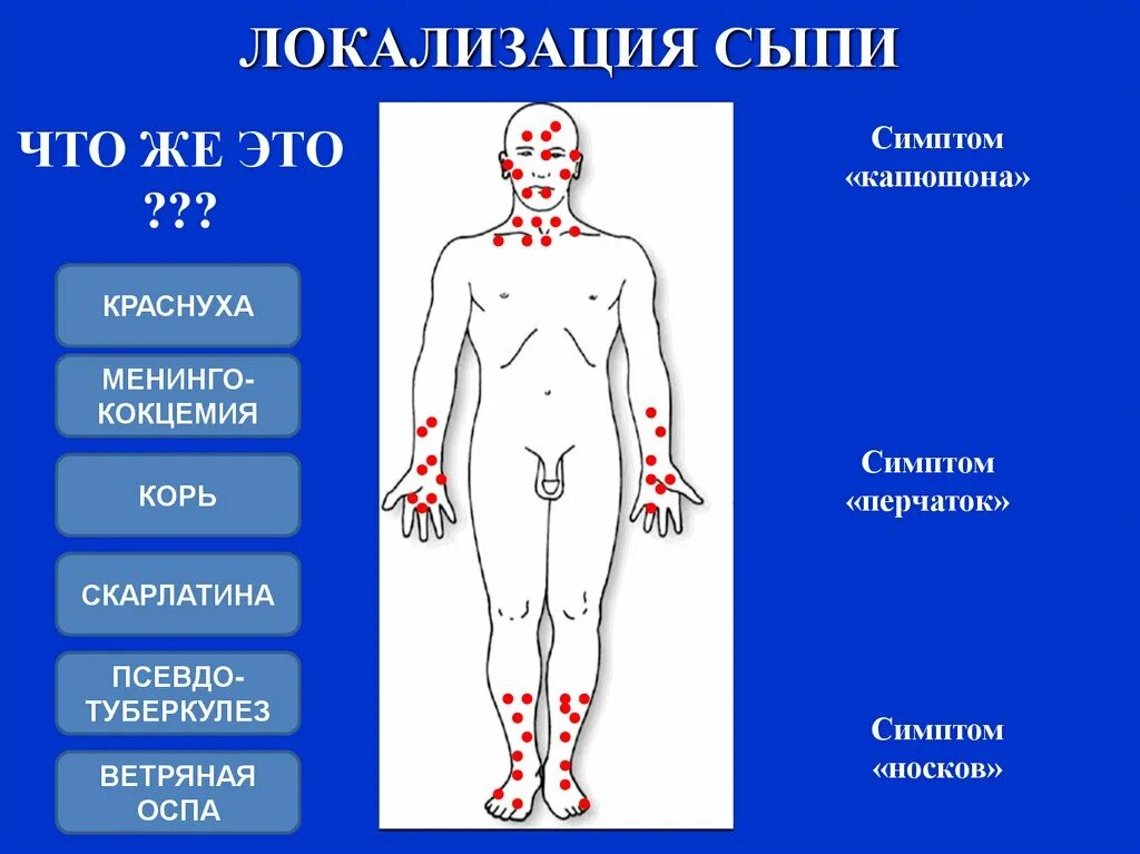 Архивы Инфекционист - Страница 5 из 15 - Совет медика