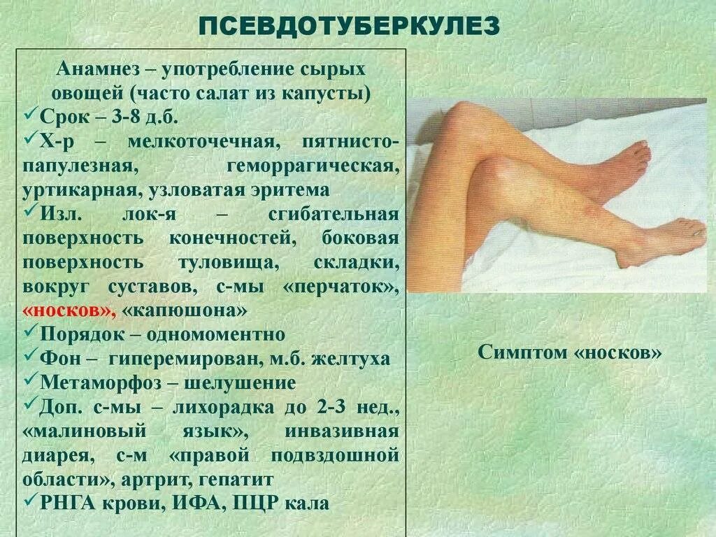 Псевдотуберкулез сыпь фото Псевдотуберкулез у детей: 6 предрасполагающих факторов, 5 групп симптомов, метод