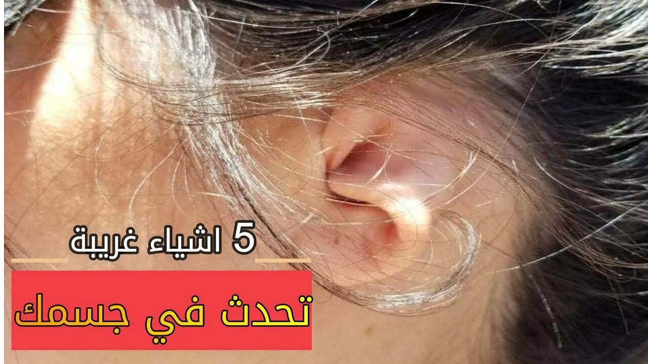 Псориаз в ушах фото 5 اشياء غريبة تحدث في الجسم - YouTube