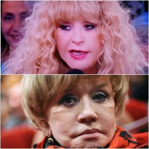 Пугачева пластика фото "It is similar to Vera Alentova": Alla Pugacheva terrified TV viewers a new face