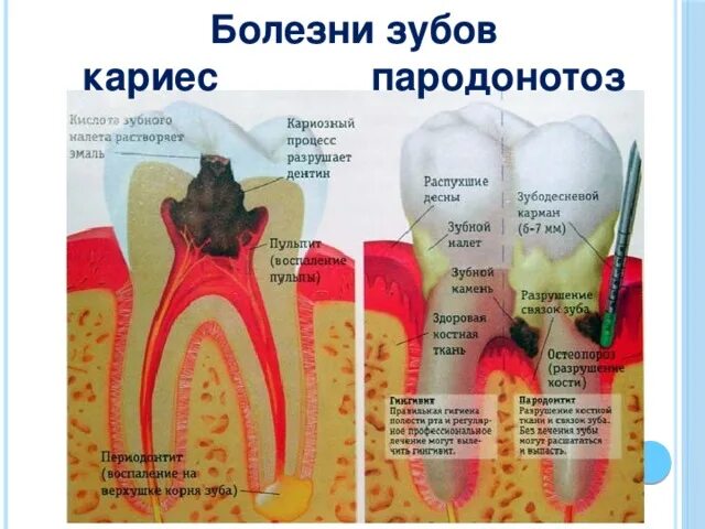 Пульпит молочного зуба фото "Строение и значение зубов". Презентация к уроку биологии.