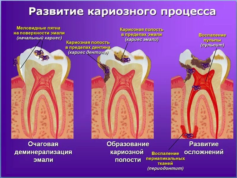 Пульпит молочного зуба фото "ОГАУЗ Томская областная клиническая больница (ТОКБ)"