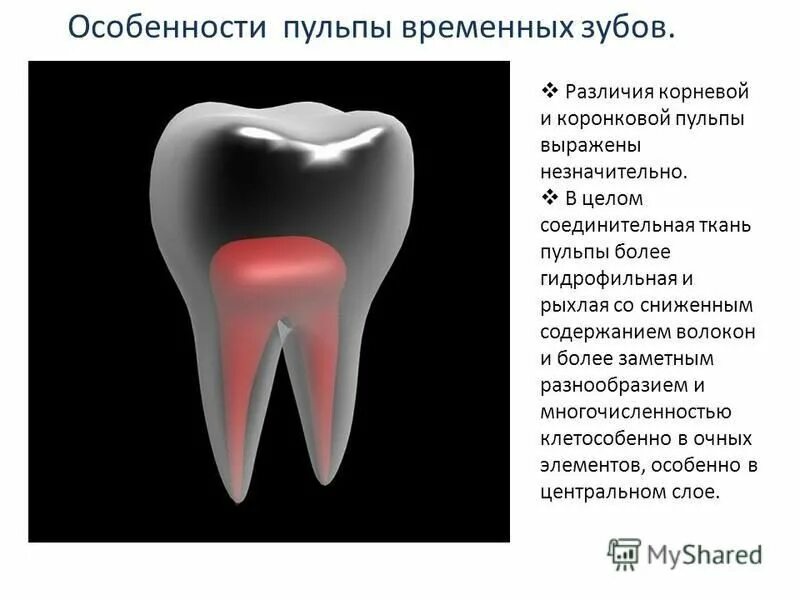 Пульпит молочного зуба фото Картинки ЧТО ТАКОЕ ПУЛЬПИТ В СТОМАТОЛОГИИ