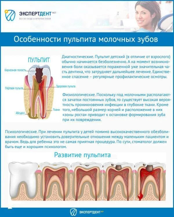 Пульпит молочного зуба фото Пульпит у детей: лечение молочных зубов в разном возрасте, профилактика