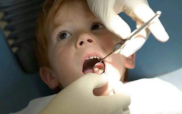 Пульпит зуба у детей фото Decayed Deciduous Teeth - Filled or Pulled? Tooth decay, Childrens dental health