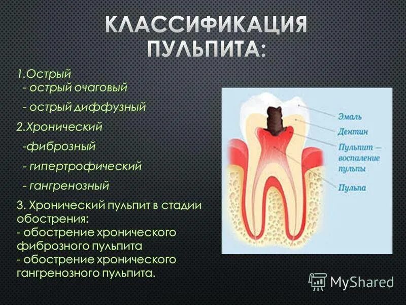 Пульпит зуба у детей фото Пульпит зуба лечение детям - найдено 88 картинок