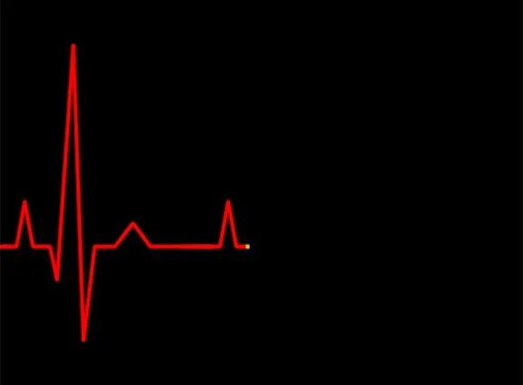 Пульс красная ул 103 фото Heartbeat monitor Aesthetic gif, Love gif, Motion design animation