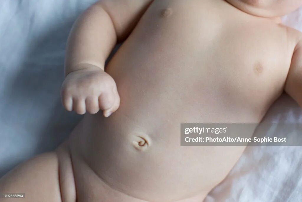 Пупочная грыжа у новорожденного фото как выглядит Baby Midsection High-Res Stock Photo - Getty Images