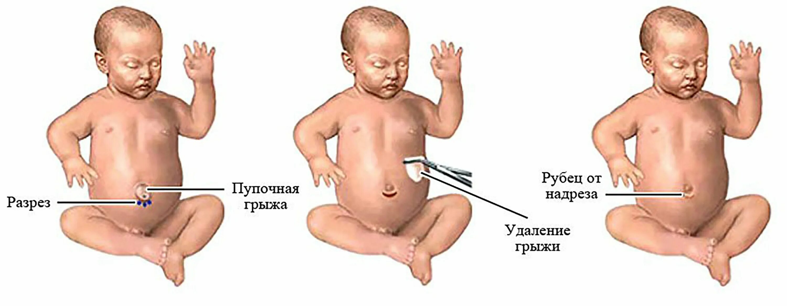 Conspiracy from hernia in adults: The ritual should be performed before sunset. 