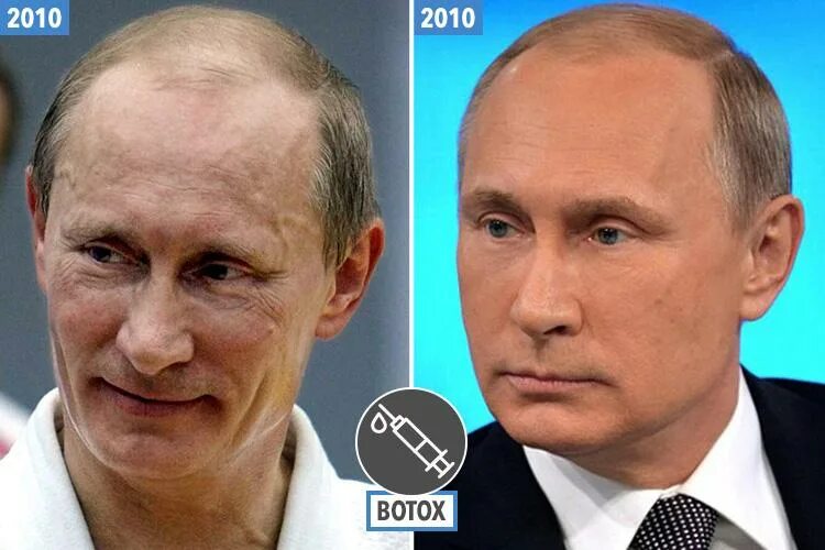 Путин пластика фото Has Putin had plastic surgery? Top cosmetic surgeon reveals exactly which proced