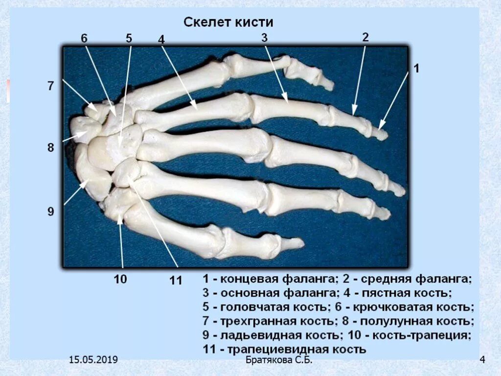 Пястная кость кисти фото Пястная кость ноги