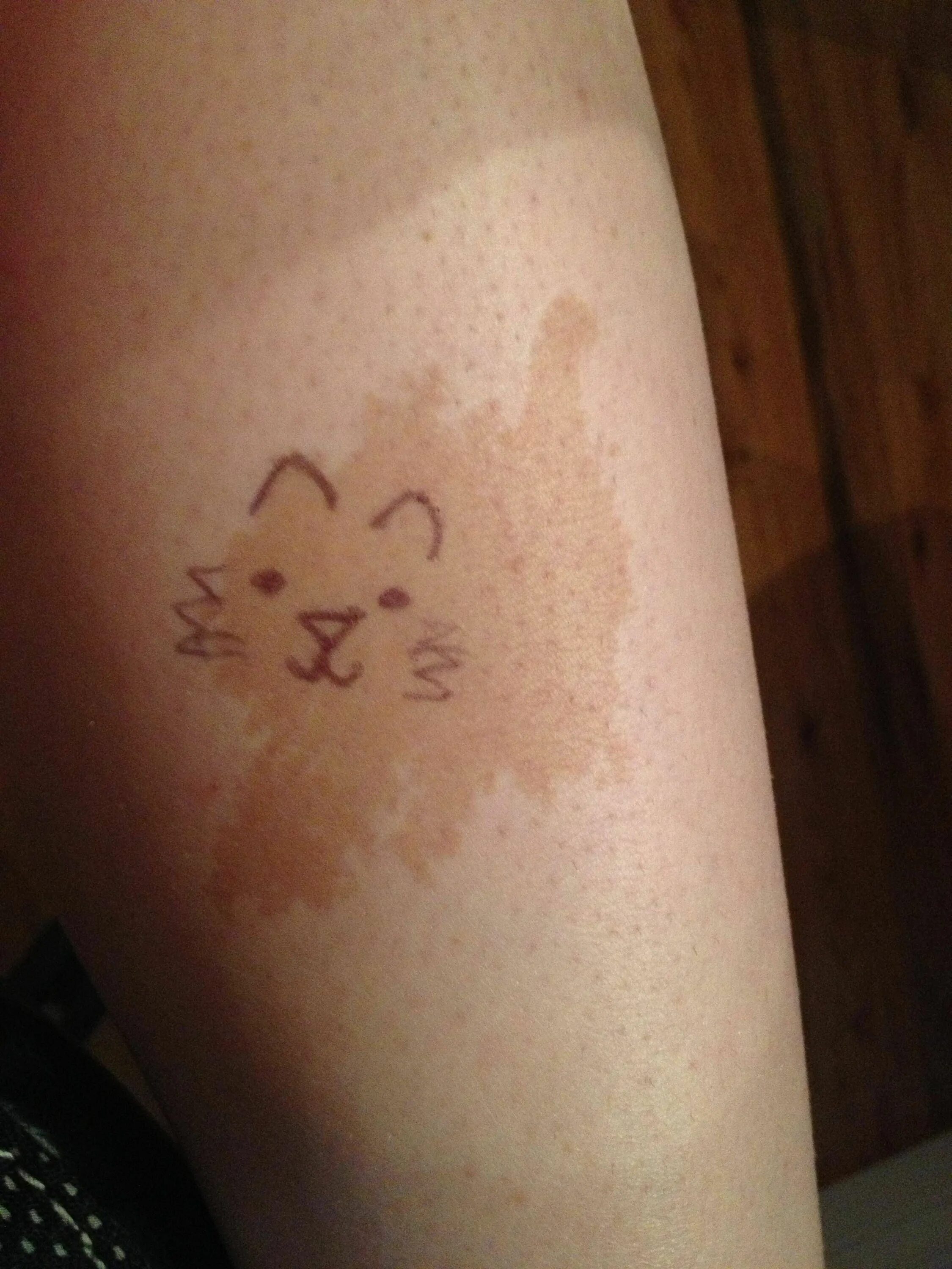 Пятна кофе с молоком фото Fun with Birthmarks :) Mini tatouages, Tache de naissance, Tatouage