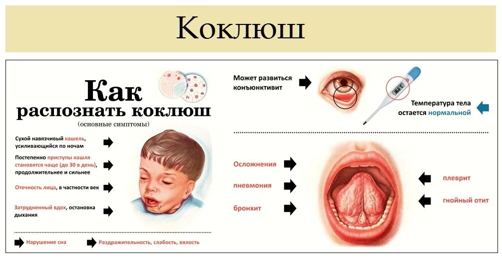 Пятна на горле у ребенка фото коклюш