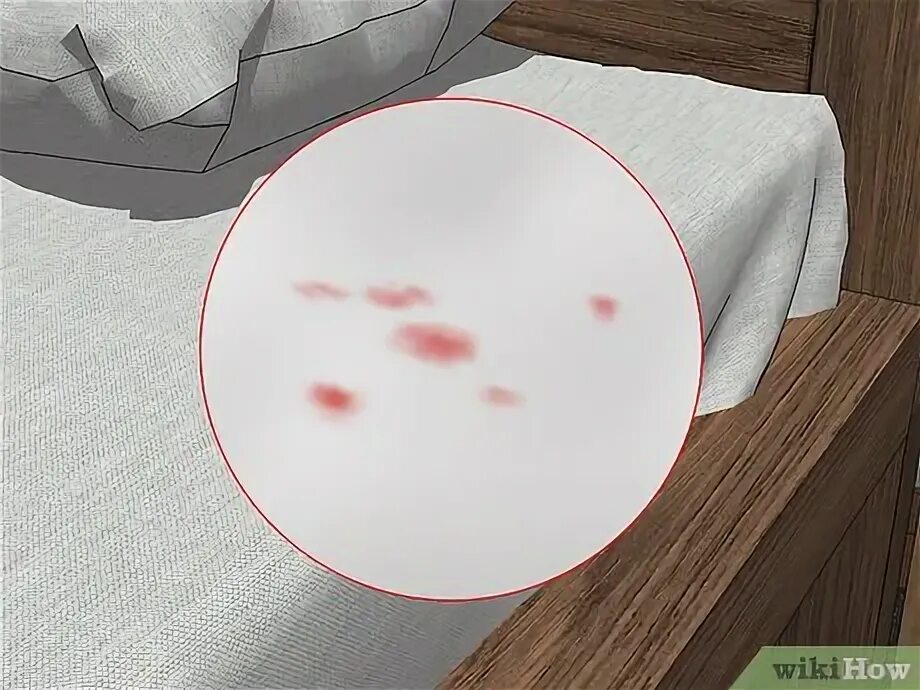 Пятна на постели от клопов фото 4 Ways to Check for Bedbugs - wikiHow