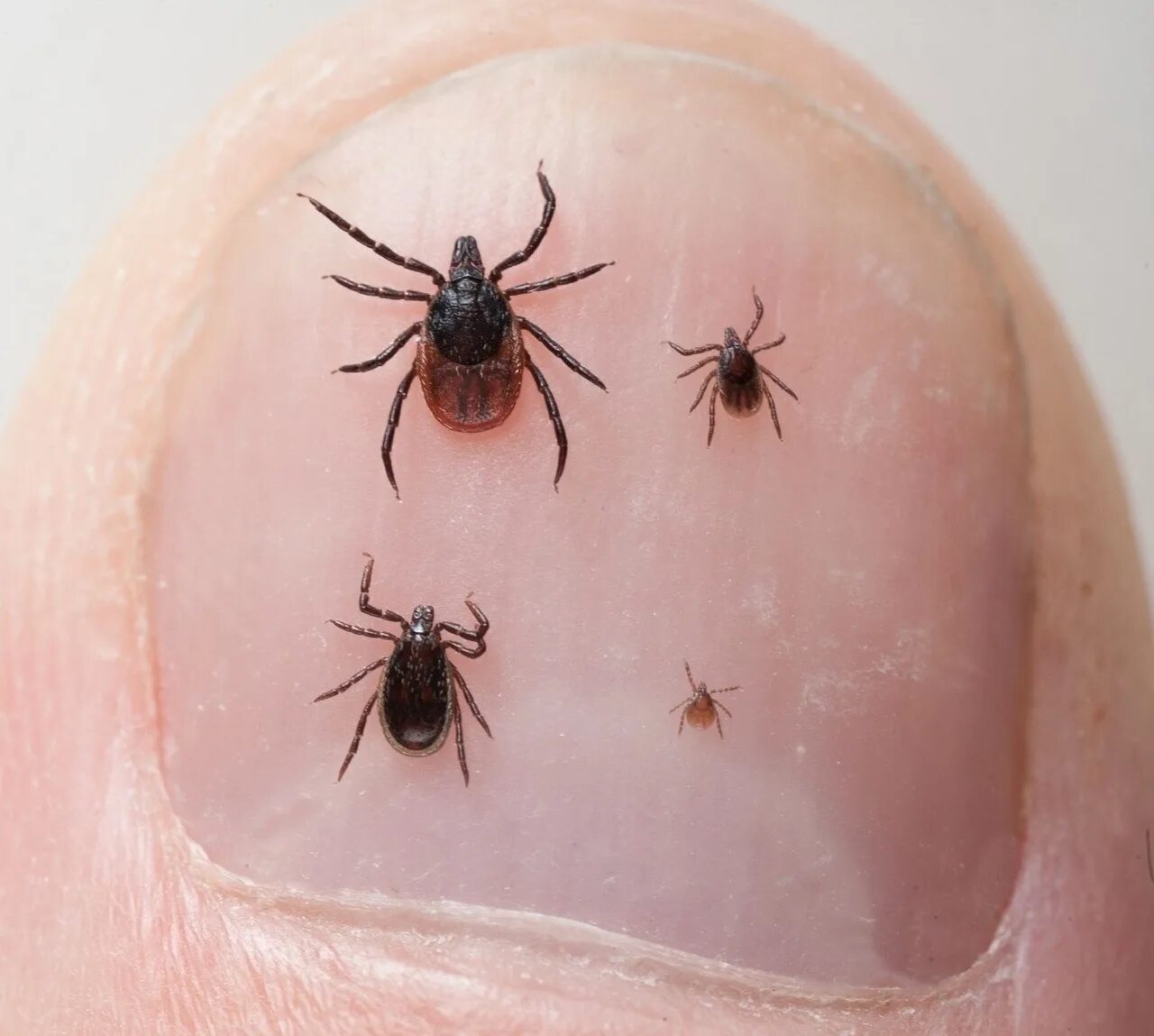 Пятнистая лихорадка от укуса клеща фото 963 people suffered from tick bites in the Nizhny Novgorod region. Bites were re