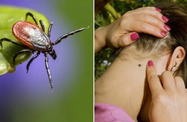 Пятно от клеща фото ❗ Rains and high grass led to an increase in tick bites More than 600 have been 