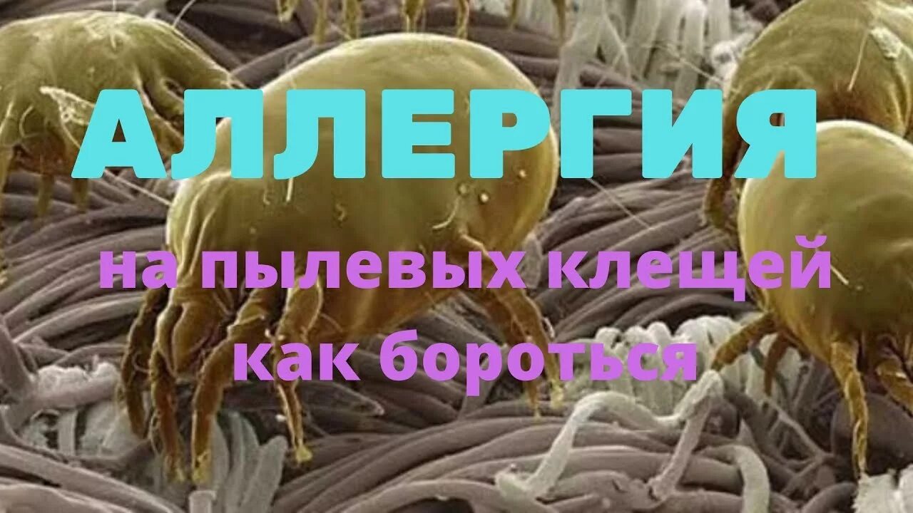 Пылевой клещ аллергия фото Аллергия на пылевых клещей как бороться - YouTube