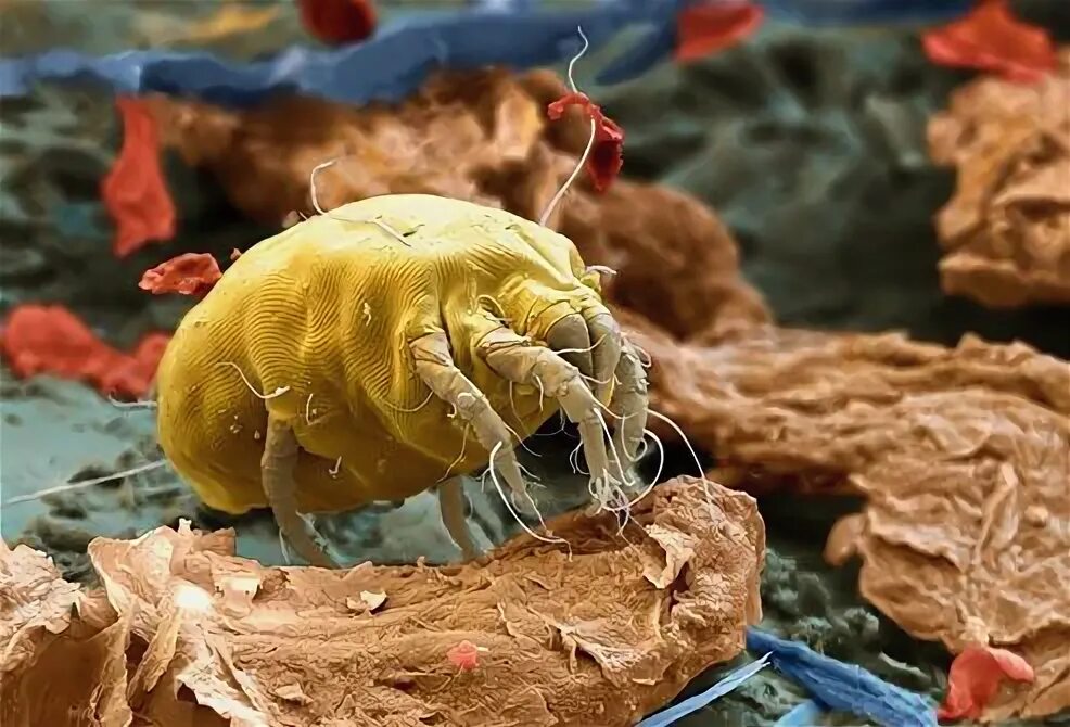 Пылевой клещ фото крупным планом The house dust mite, you have thousands of these little dudes in your mattress..