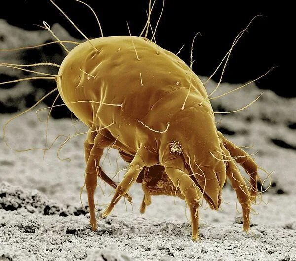 Пылевой клещ фото крупным планом домашний Print of Cheese Mite Micro photography, Scanning electron micrograph, Mites