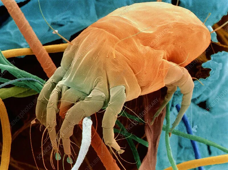 Пылевой клещ фото на теле Dust mite - Stock Image - Z445/0173 - Science Photo Library