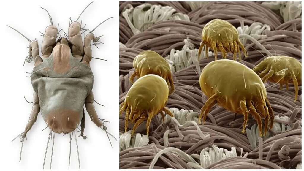 Пылевой клещ на коже человека фото Каких животных не станет, если исчезнут люди Мир домашних животных Дзен