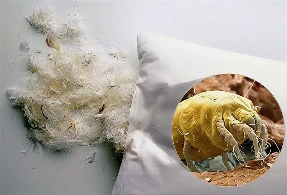 Пылевые клещи аллергия на коже фото How to Get Allergy Relief at Home Cleaning pillows, Dust mites, Pillows