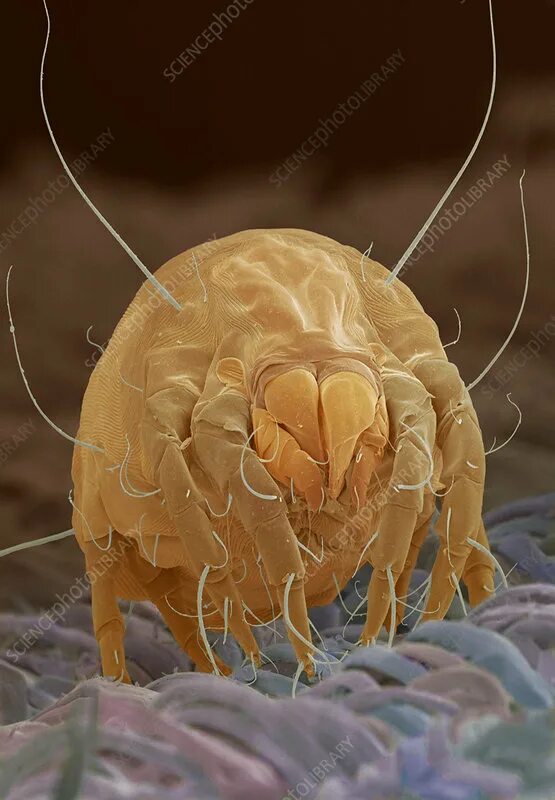 Пылевые клещи фото Dust mite - Stock Image - Z445/0298 - Science Photo Library