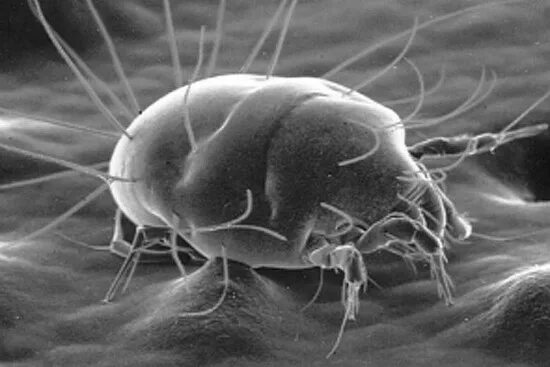 Пылевые клещи фото под микроскопом на постели How are dust mites harmful to humans?