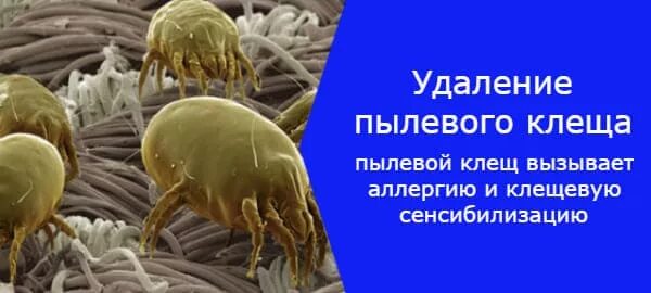 Пылевые клещи укусы фото на теле человека 42424 ProChisto