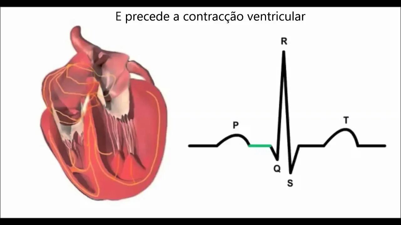 Работа сердца фото Noções Básicas de ECG - YouTube