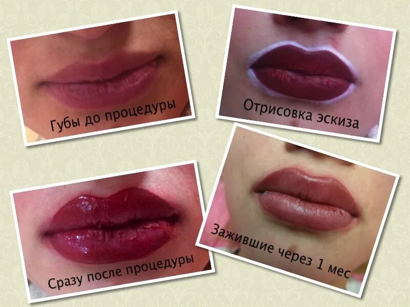 Semi-Permanent lip color Make You Look Vibrant #Zarpash Beauty Clinic - YouTube