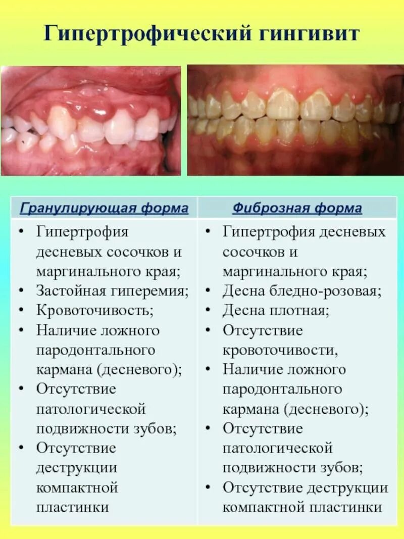 Рак десны симптомы фото признаки План лечения пародонтоза