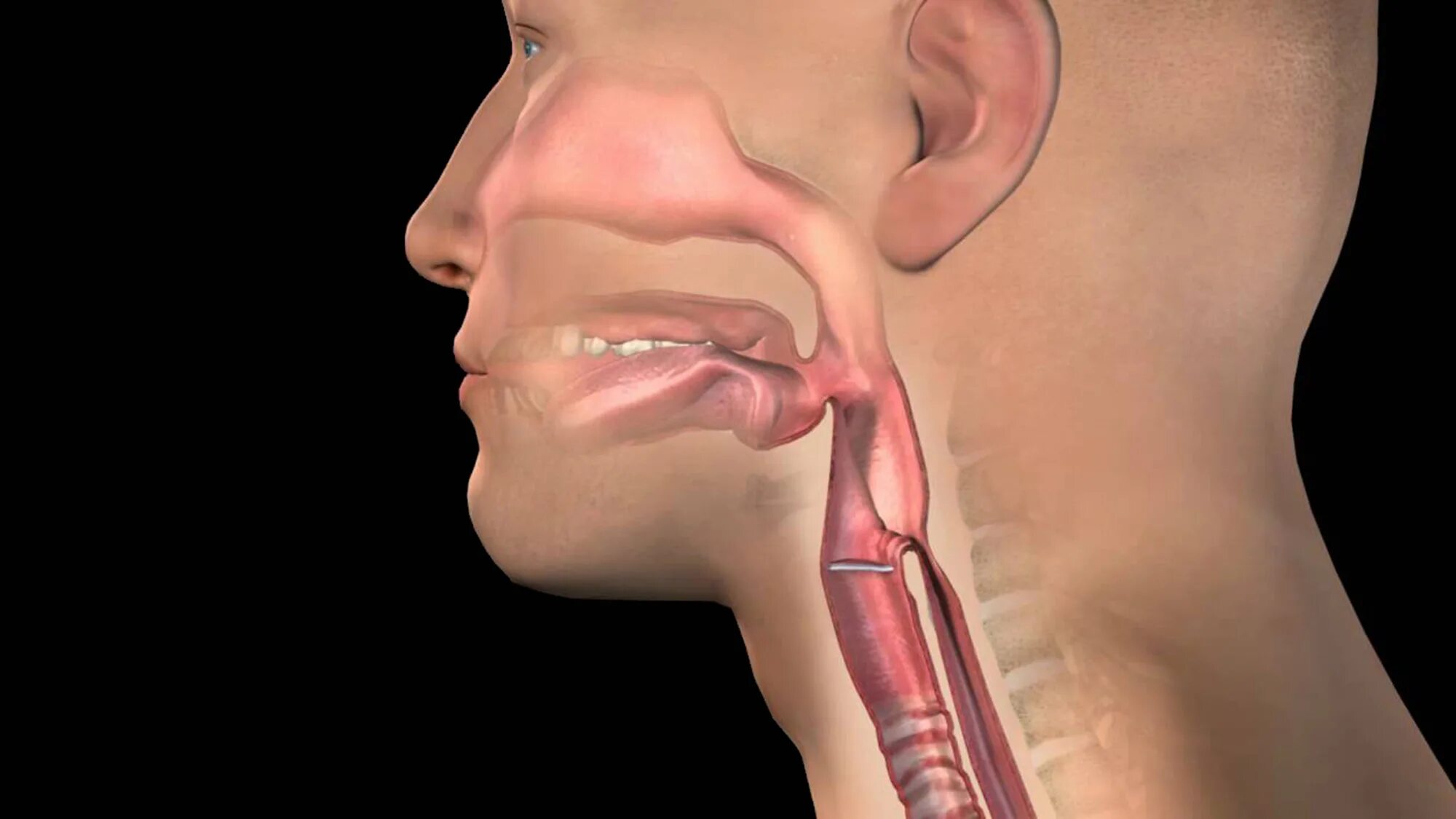 Рак горла как выглядит в живую Горло во время глотания