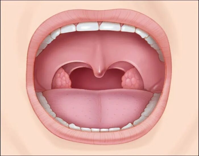 Рак горла как выглядит язык Oral Cavity Quiz