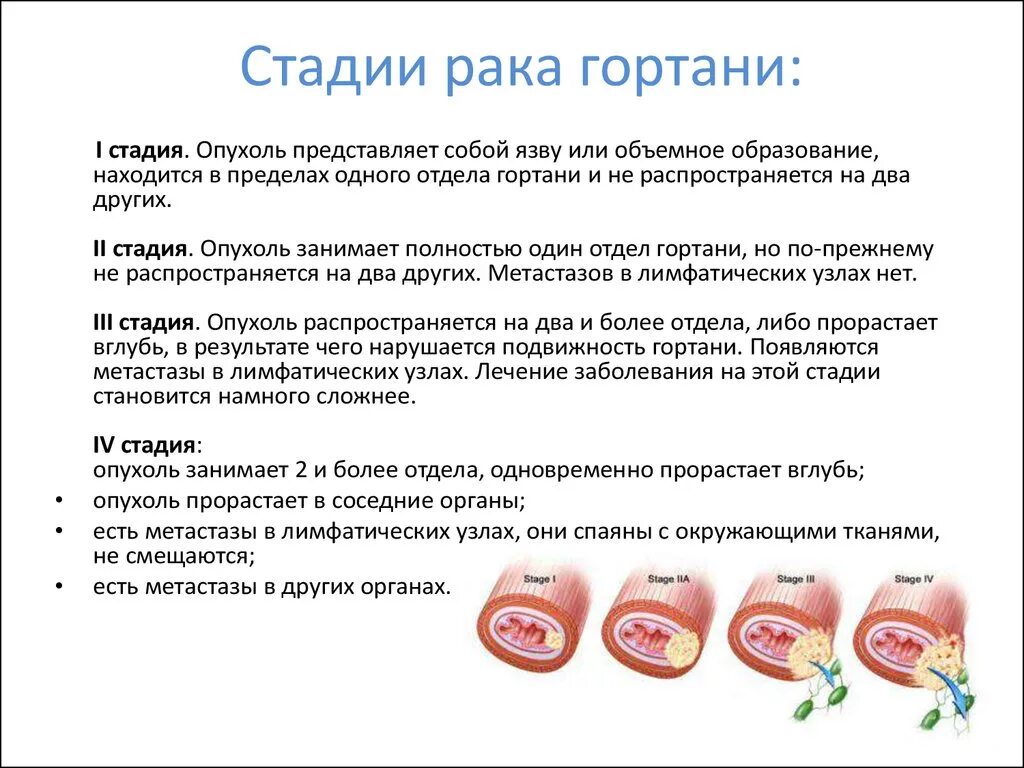 Рак горла стадии фото Рак гортани - презентация онлайн