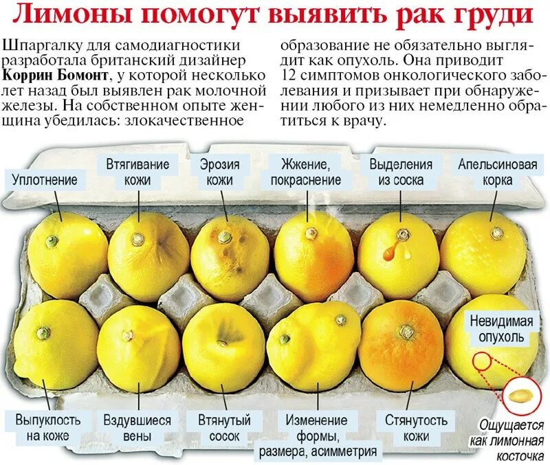 Рак груди первой стадии фото Профилактика рака молочной железы Клиника "Я здорова!