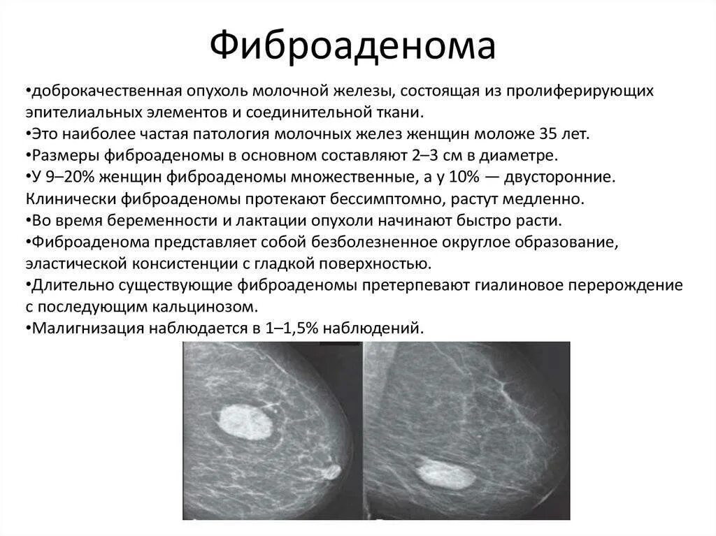 Рак груди у мужчин симптомы признаки фото Susp c r