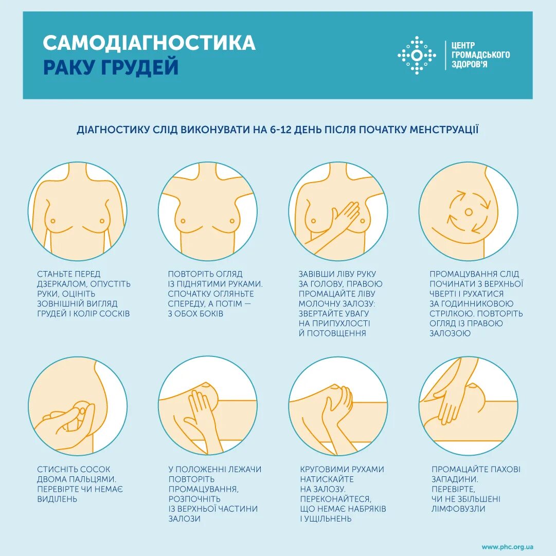 Рак груди1 симптомы фото Самодіагностика раку грудей - Балтський центр ПМСД