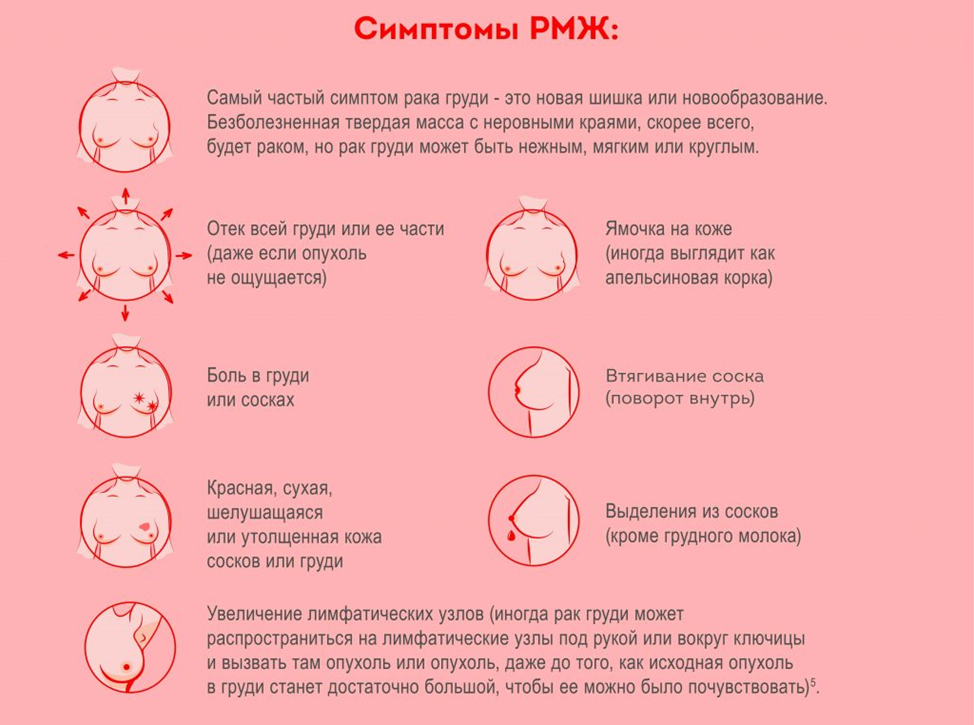 Рак груди1 симптомы фото Рак молочной железы Детская городская поликлиника № 81