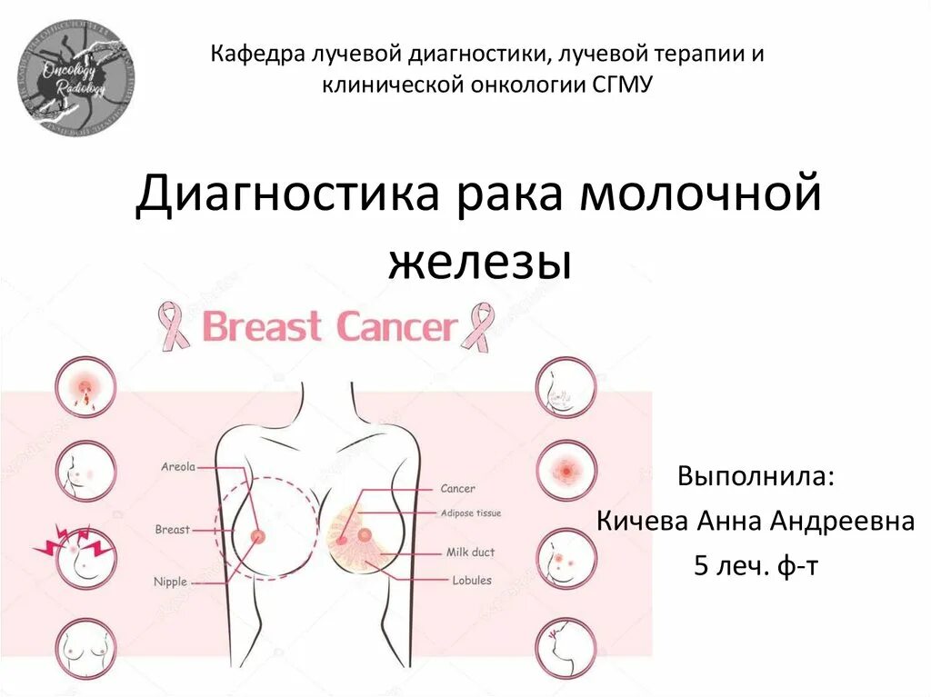 Рак груди1 симптомы стадии фото Диагностика рака молочной железы - online presentation