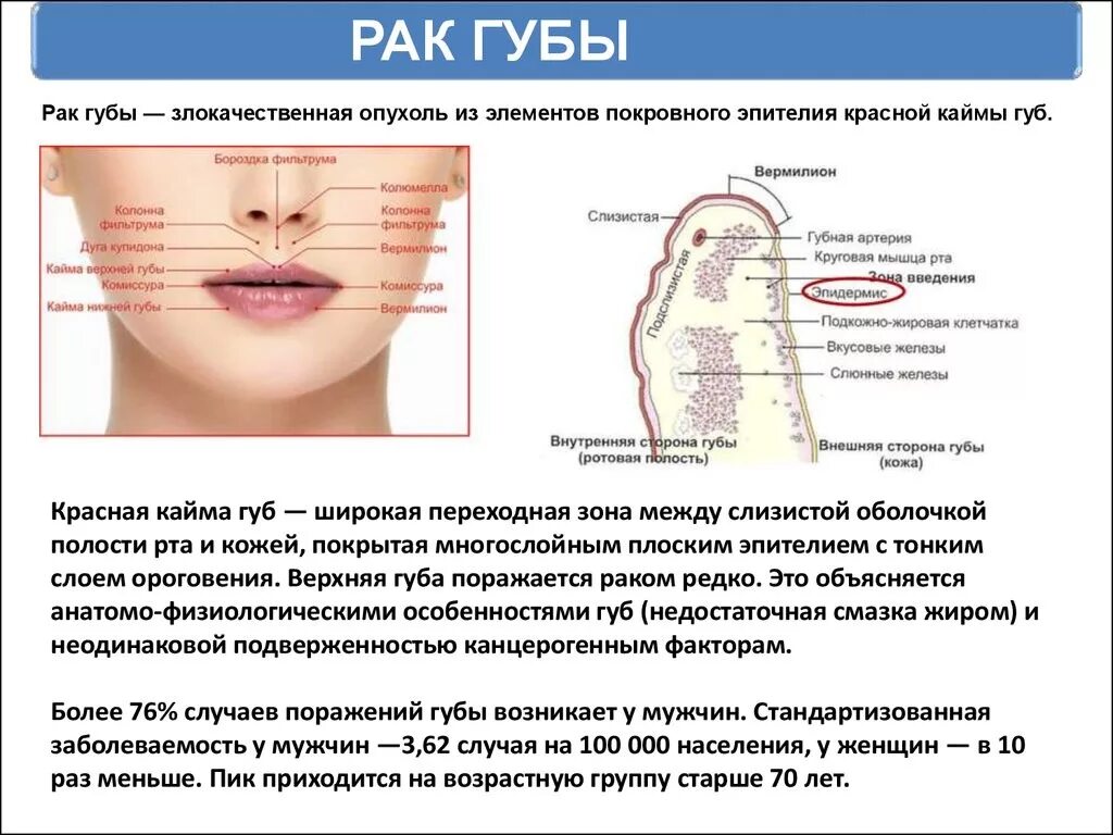 Рак губы симптомы фото лечение Информационные материалы по раннней диагностике новообразований полости рта и гл