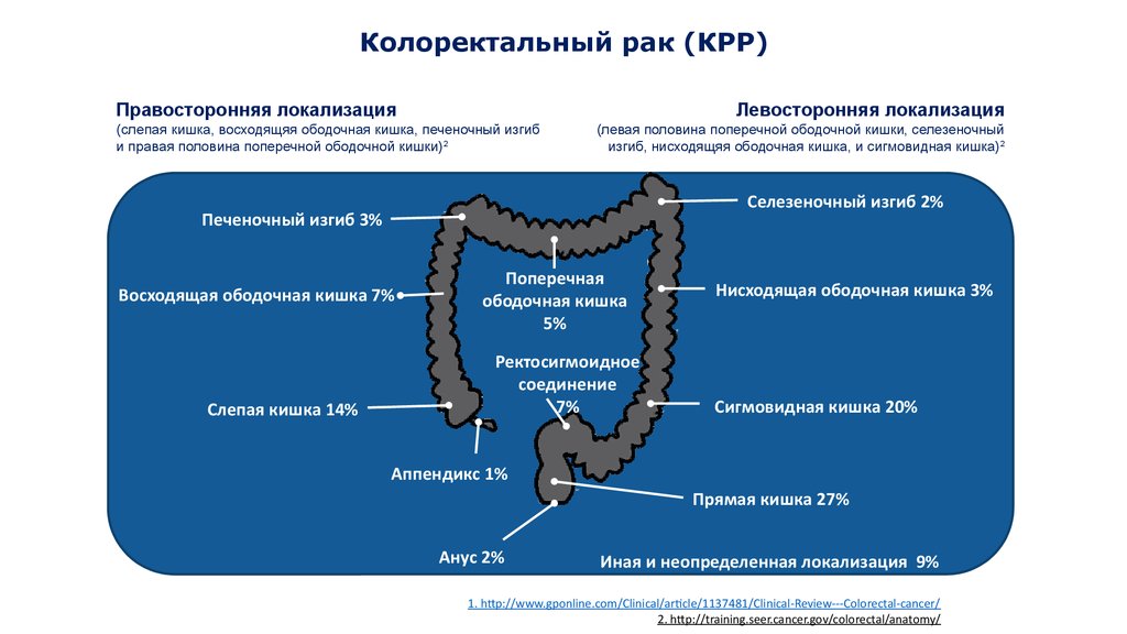 Рак кишечника стадии фото Рак толстой кишки симптомы признаки