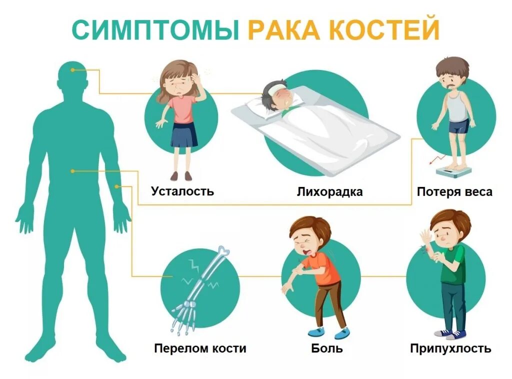 Рак костей признаки фото Доброкачественные опухоли костей у детей - диагностика и лечение в Москве ЦИТО