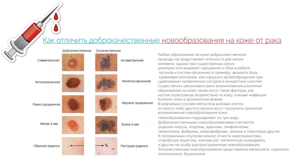 Лечение и удаление новообразований кожи Отделение платных медицинских услуг КДЦ 