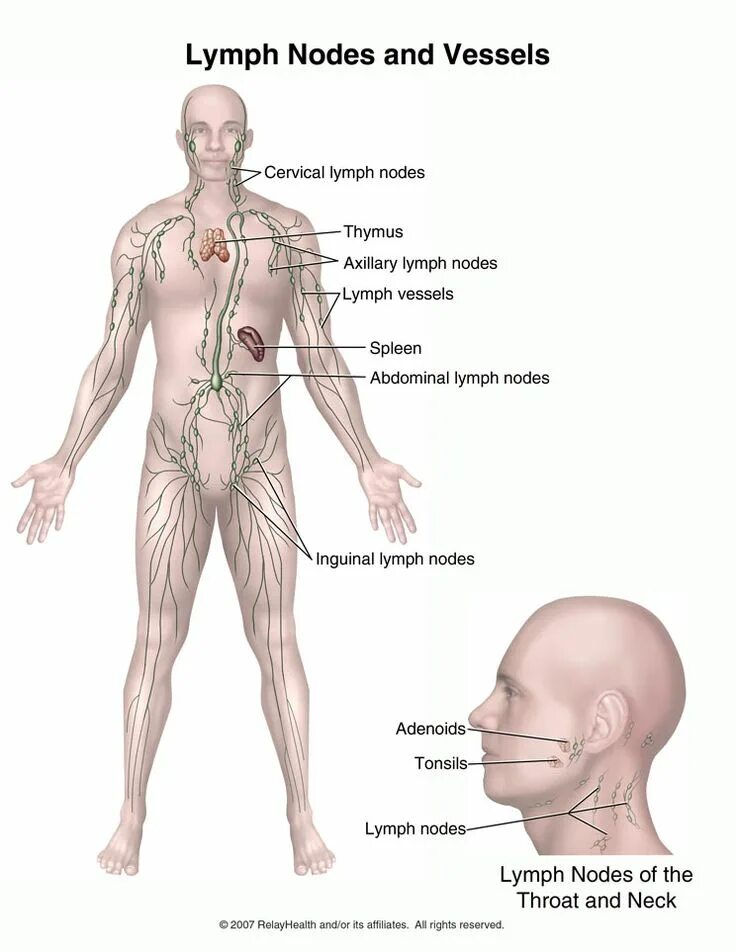 Рак лимфатической системы фото Pin on Disease and Symptoms