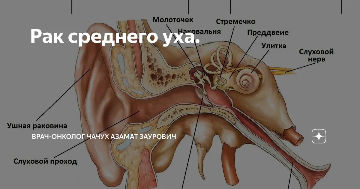 Рак на ухе у человека фото Рак среднего уха. Врач-онколог Чачух Азамат Заурович Дзен