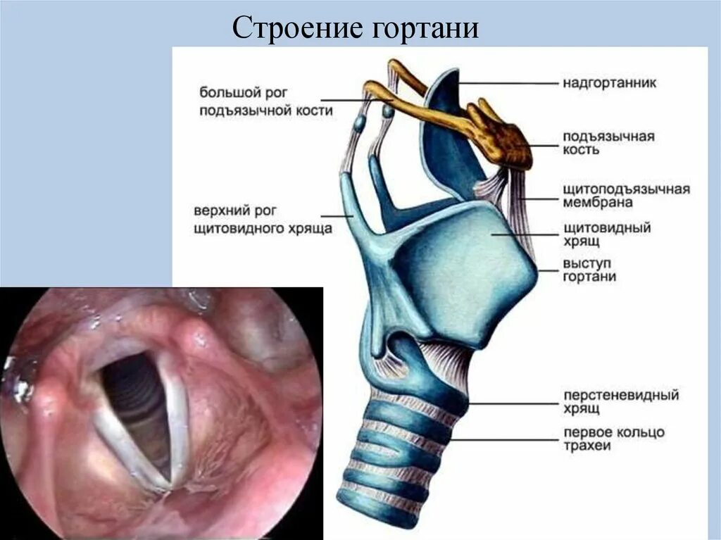 Рак надскладочного отдела гортани фото Объект гортань процесс