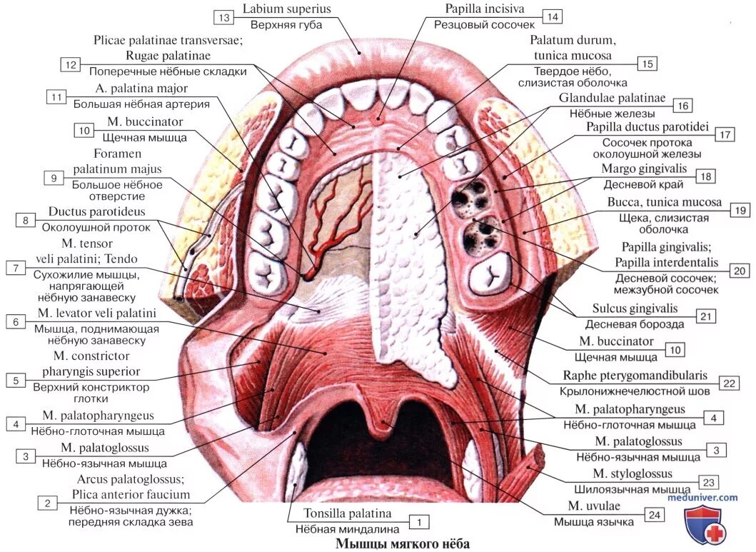 Рак неба во рту фото Анатомия: Нёбо, palatum. Твердое небо. Мягкое небо