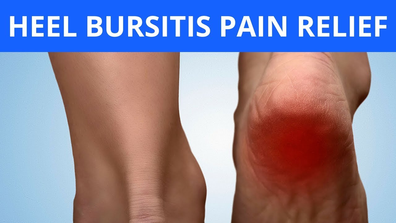 Рак ноги фото начальная стадия Heel Bursitis Pain Relief - YouTube